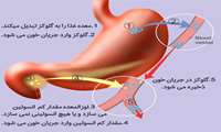 امروزه مقاومت به انسولین شیوع زیادی پیدا کرده است که برای پیشگیری از تبدیل آن به دیابت با یک آزمایش ساده می توان از ابتلا با عدم ابتلا به آن اطلاع پیدا کرد و بهترین راه خلاصی از آن تبعیت از رژیم غذایی سالم است.